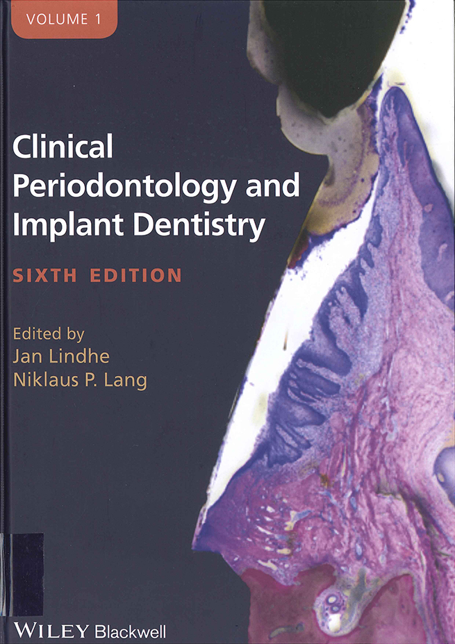 Sexta edición de “Clinical Periodontology and Implant Dentistry” del Prof. Jan Lindhe. con la colaboración de el Dr. Fabio Vignoletti del Grupo PerioCentrum.