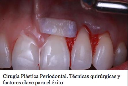 artículo de Periocentrum en la revista especializada El Dentista Moderno