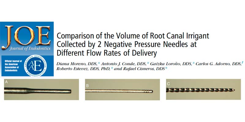 Gaizka Loroño - PerioCentrum Bilbao- participa en el desarrollo de una investigación en el campo de la endodoncia