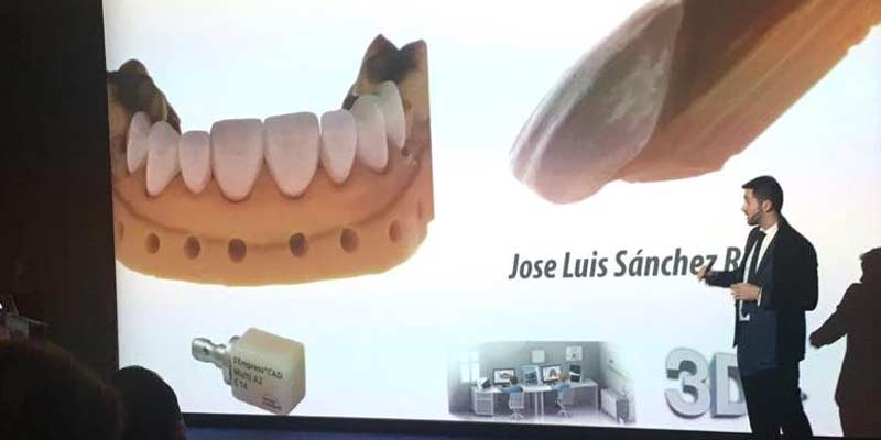 Odontología restauradora: el futuro ya está aquí