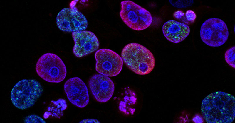 La Periodontitis y La Disfunción Eréctil