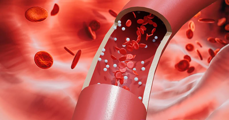 medicacion para la sangre implantes