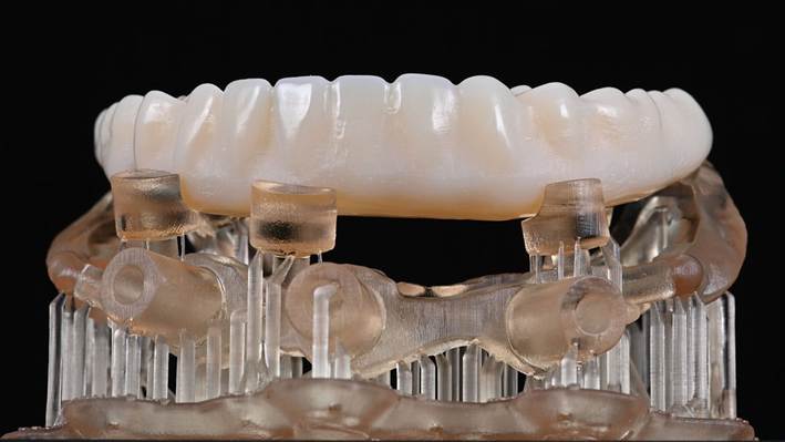 Impresión 3D / CAD-CAM para prótesis e implantes personalizados