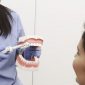 Cuidados diarios para pacientes con implantes dentales y antecedentes periodontales