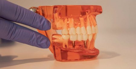Tendencias en Periodoncia e Implantes para 2026: Técnicas Mínimamente Invasivas
