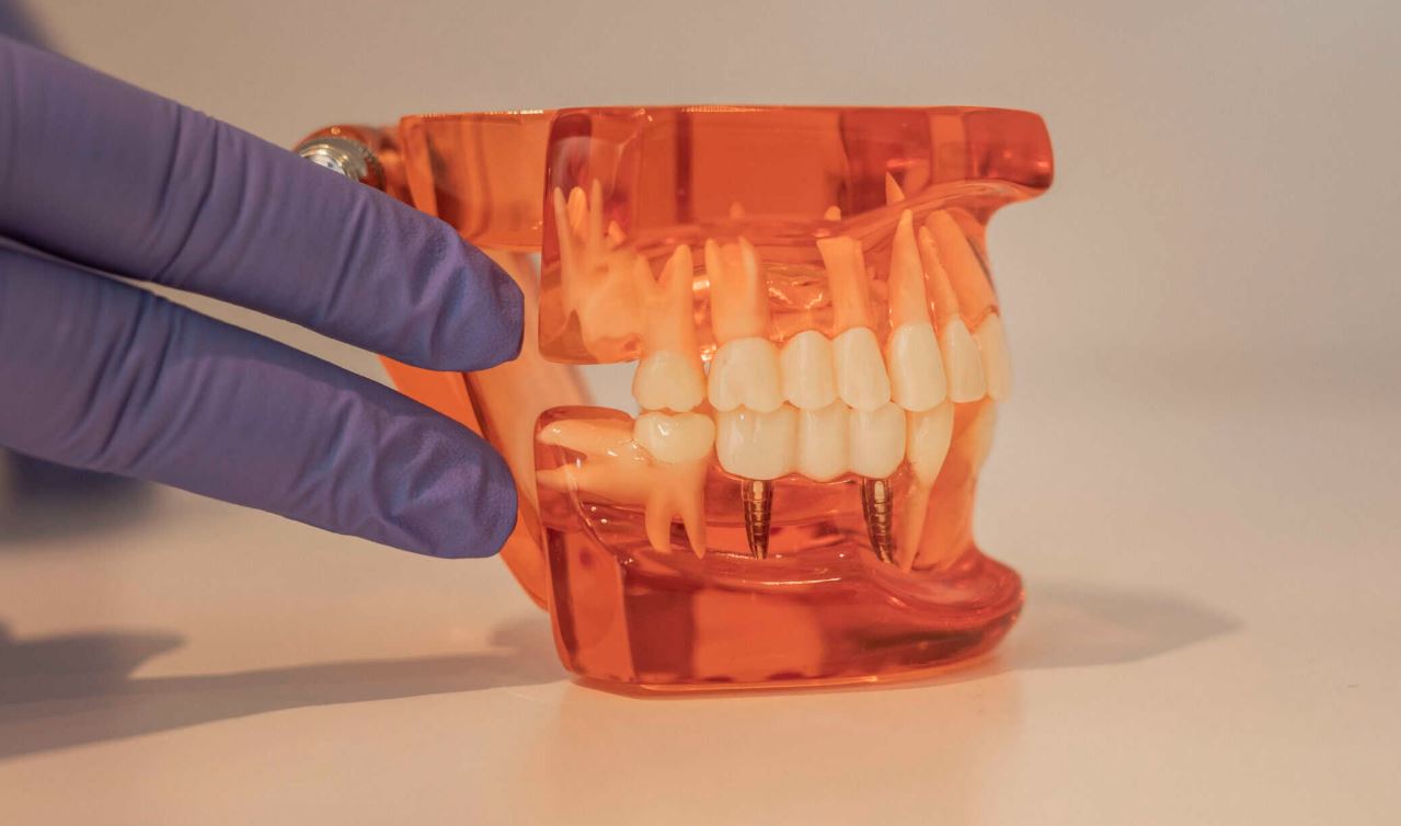 Tendencias en Periodoncia e Implantes para 2026: Técnicas Mínimamente Invasivas